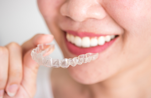 tooth-extraction-with-invisalign-1 インビザラインのイメージ